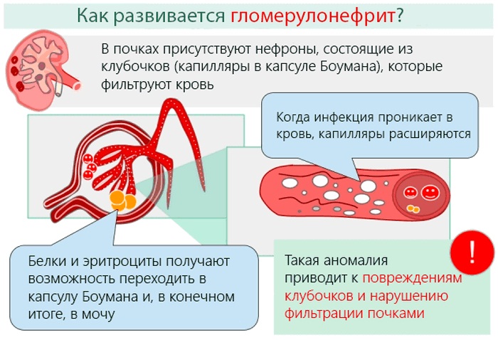 Эпителий плоский в моче повышен у женщин при беременности, ребенка, мужчин. Что это значит, причины, лечение