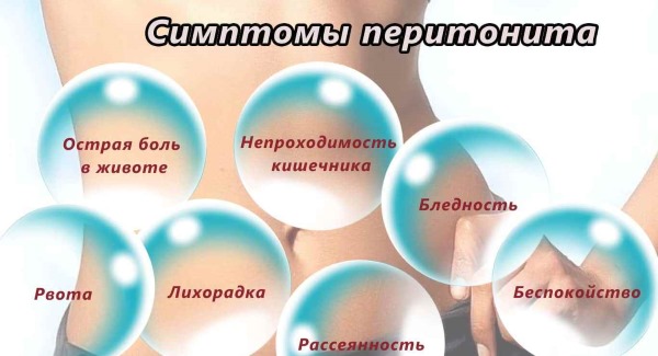 Болезни желчного пузыря у женщин, мужчин и детей. Симптомы и лечение народными средствами, препараты
