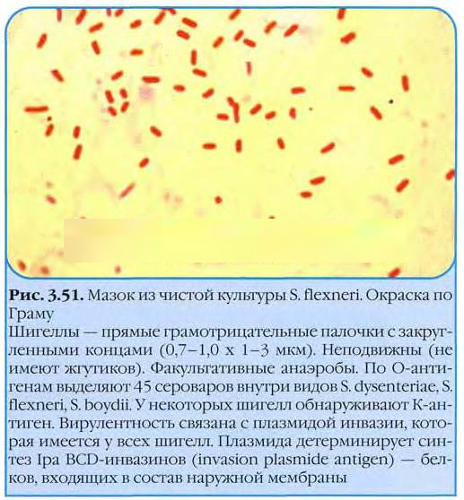 Боли в животе при дизентерии. Характер, где локализуются
