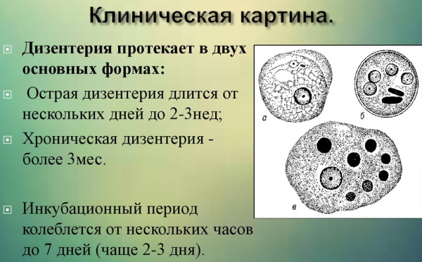 Боли в животе при дизентерии. Характер, где локализуются