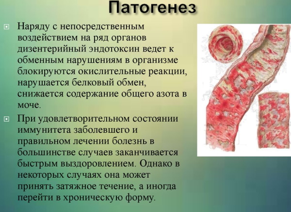 Боли в животе при дизентерии. Характер, где локализуются