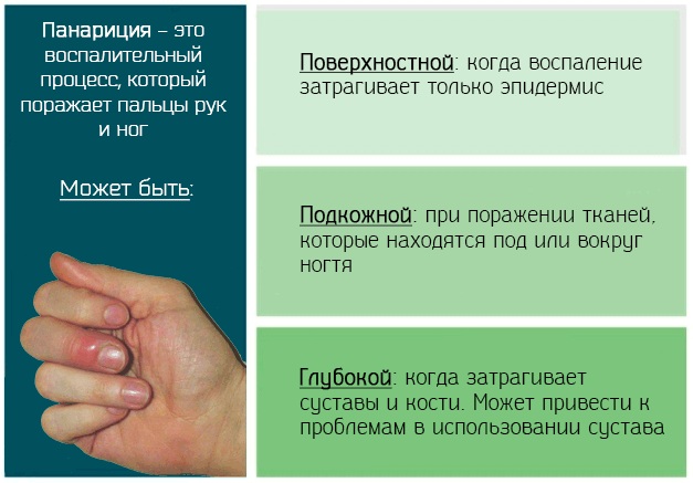 Пиобактериофаг комплексный (pyobacteriofag combined). Инструкция по применению, цена, отзывы