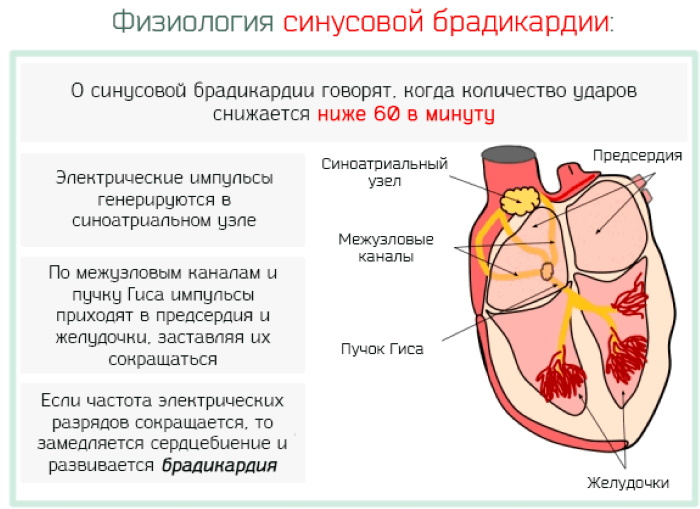 Брадикардия сердца у взрослых. Что это такое, причины, симптомы, лечение. Препараты