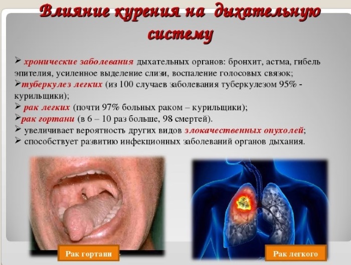 Как лечить хронический бронхит курильщика. Симптомы и лечение, препараты, народные средства, антибиотики