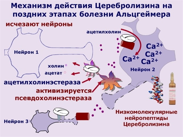 Церебролизин уколы. Инструкция, показания к применению, цена, отзывы