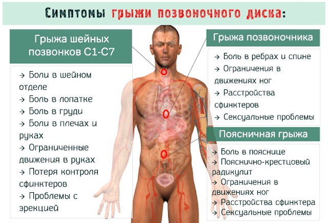 Симптом Кернига и Брудзинского при менингите, ОНМК, паркинсоне, инсульте. Что это такое, как проверить