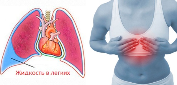 При дыхании слышен свист в бронхах, носу, горле у взрослого, ребенка, что значит, чем лечить