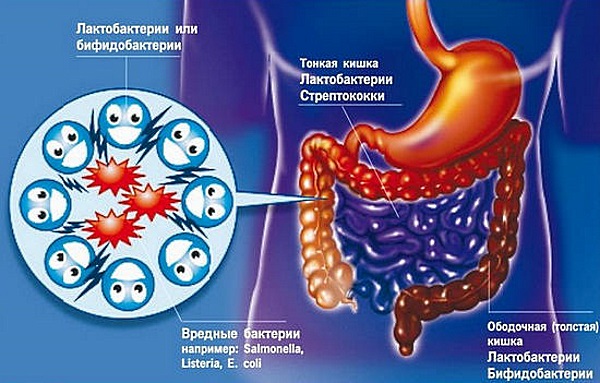 Диета при дисбактериозе кишечника у взрослых. Лечение питанием в домашних условиях. Продукты
