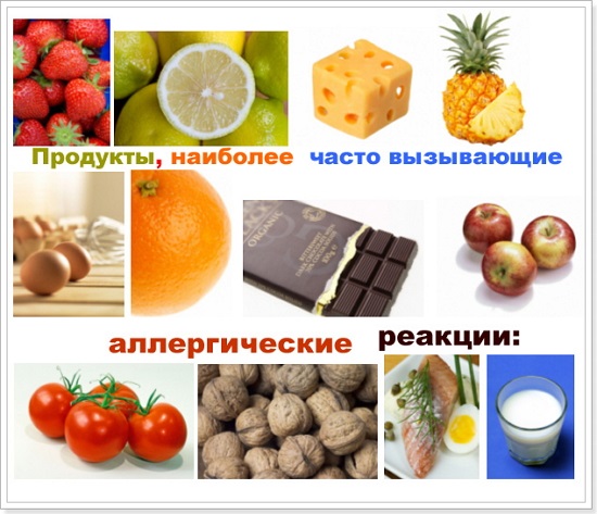 Дисгидроз кистей рук и стоп. Фото у детей, лечение, народные средства
