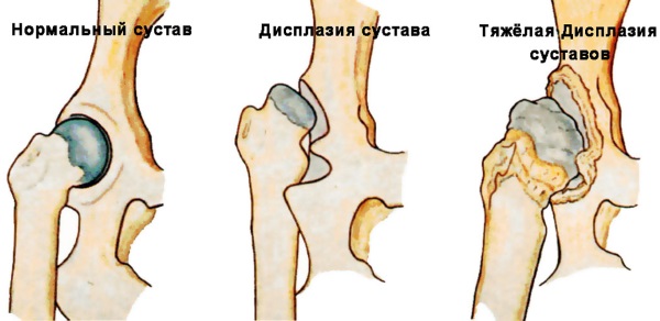 Ребенок не сидит самостоятельно в 6-7-8-9-10 месяцев. Что делать