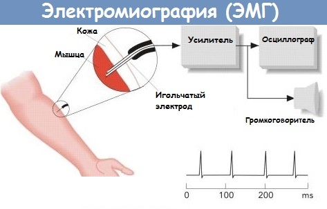 Дизартрия в логопедии. Что это такое у взрослых, детей, виды, как лечить, причины