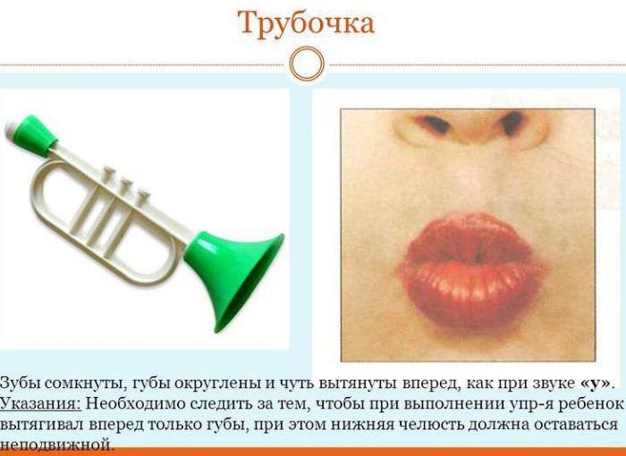 Дизартрия в логопедии. Что это такое у взрослых, детей, виды, как лечить, причины