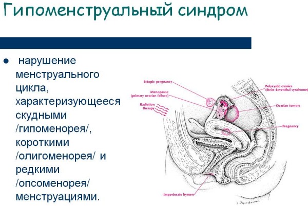 Достинекс. Инструкция по применению для прекращения лактации. Отзывы
