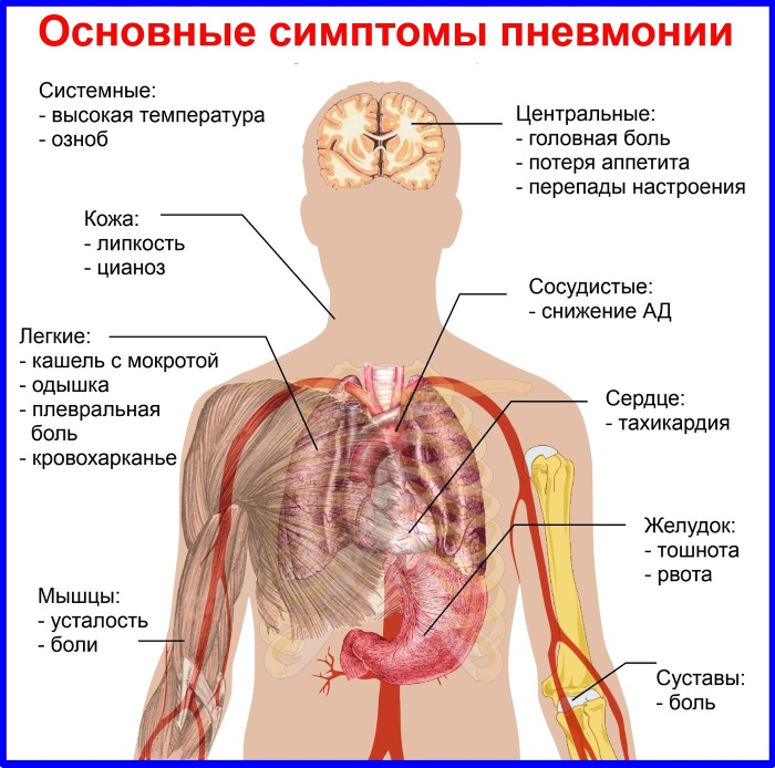 Эффективные лекарства от кашля взрослым. Препараты, антибиотики и народные средства