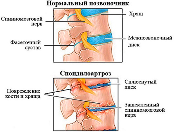 Дилакса (Dilaxa) 200 мг. Инструкция по применению, цена, отзывы, аналоги