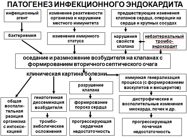 Эндокардит у взрослых. Симптомы, диагностика и лечение