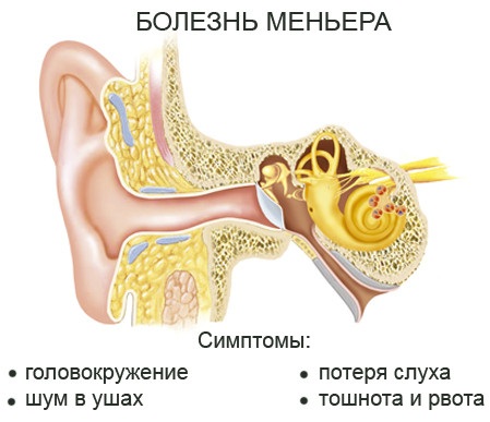 Фезам (Phezam). Отзывы пациентов принимавших препарат, инструкция по применению, аналоги, цена