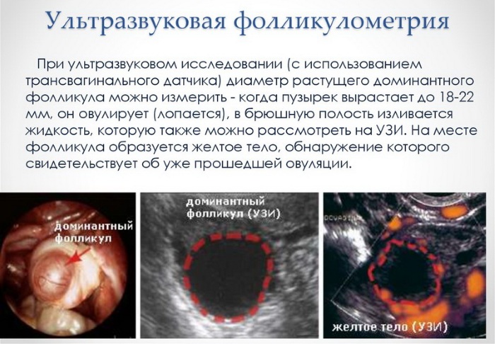 Фолликулы в яичниках. Норма количество в 30-40-50 лет, при беременности, менопаузе, размеры