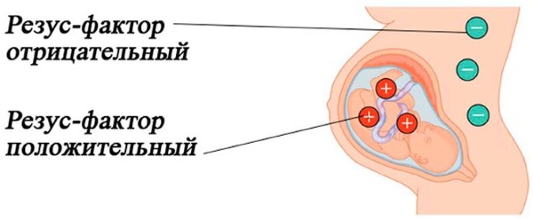 Общее недоразвитие речи. Что это, характеристика 1-4 уровня, профилактика, система коррекции