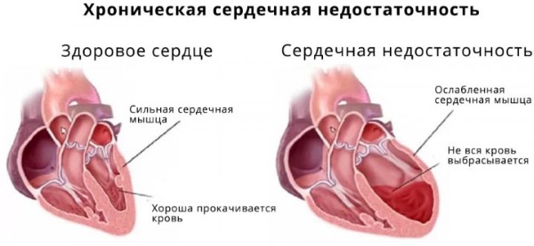 Соленая слюна во рту. Причины у женщин, мужчин, новорожденного, лечение