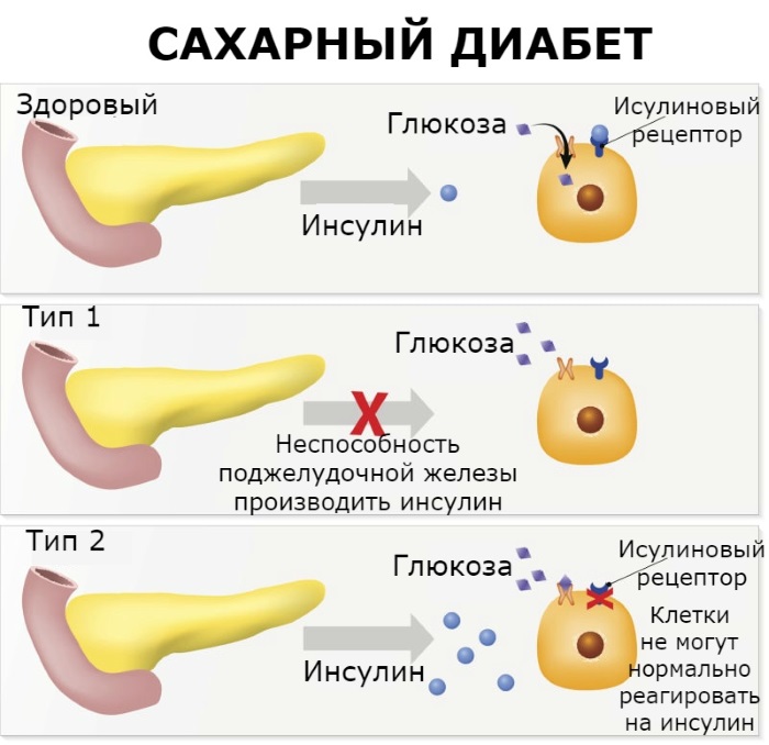 Гемостазиограмма. Что это такое при беременности, в чем разница с коагулограммой, расшифровка показателей