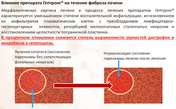Гептронг. Инструкция по применению, отзывы, цена