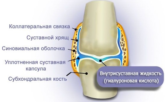 Артра (Artra). Отзывы больных применяющих этот препарат, инструкция, аналоги, цена