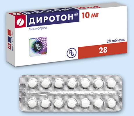 Гипертрофия правого желудочка на ЭКГ. Признаки, лечение