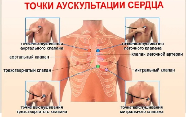 Гипертрофия правого желудочка на ЭКГ. Признаки, лечение