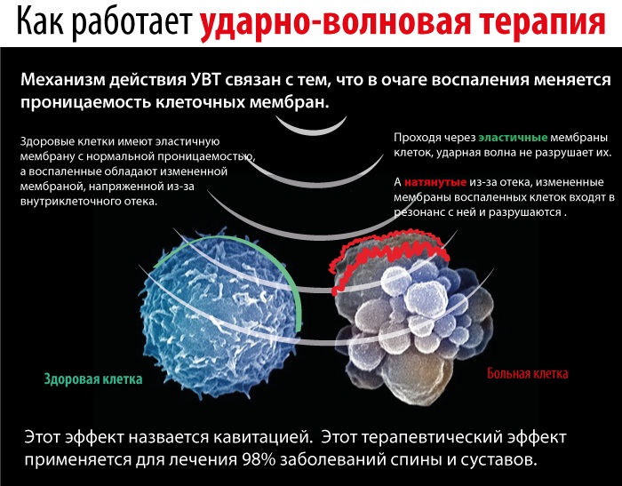Болезни тазобедренного сустава у женщин. Симптомы, первые признаки, лечение, причины