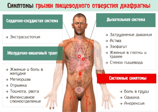 Грыжа пищевода. Лечение без операции народными средствами, диета