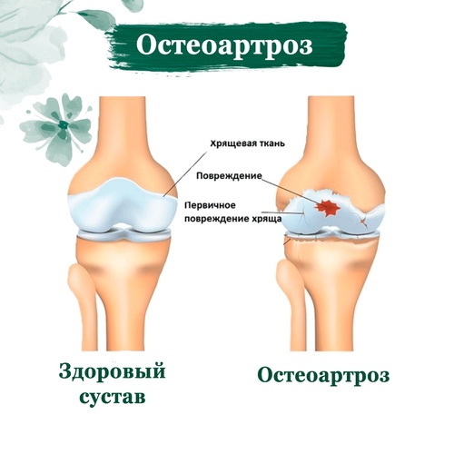Хондроксид мазь. Инструкция по применению, цена, аналоги, отзывы