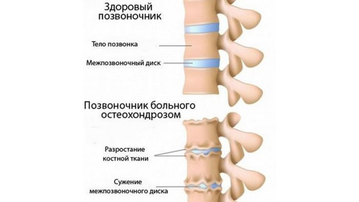Хондроксид мазь. Инструкция по применению, цена, аналоги, отзывы