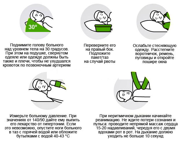 Микроинсульт у молодых девушек. Симптомы, возраст, лечение