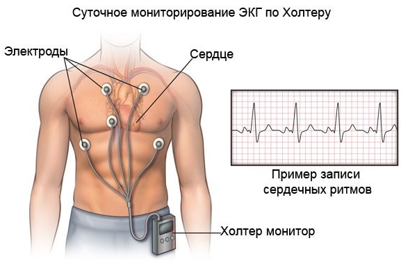 Густая желчь. Причины и лечение, симптомы, что делать, лекарства, диета