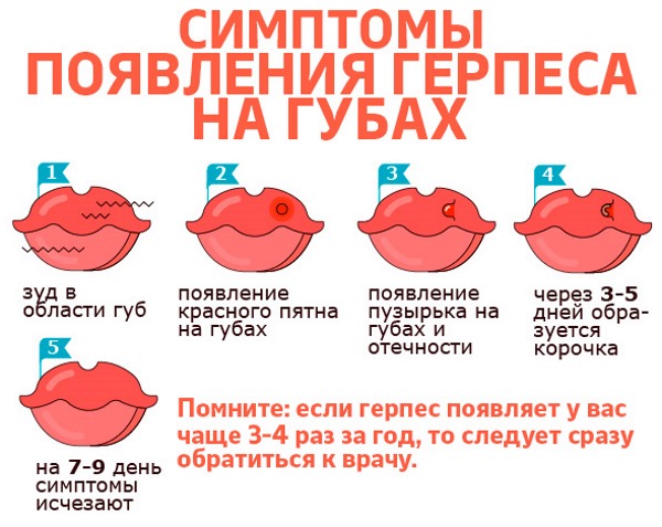 Как лечить герпес на губах народными средствами, медикаментозно у детей, взрослых, при беременности
