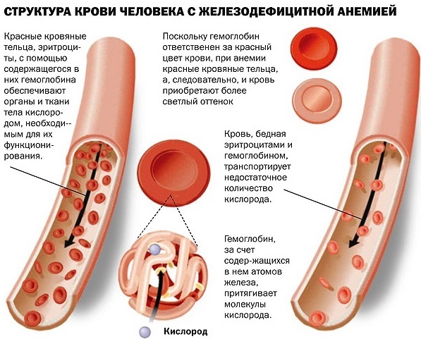 Как поднять лейкоциты в домашних условиях народными средствами, препаратами после химиотерапии