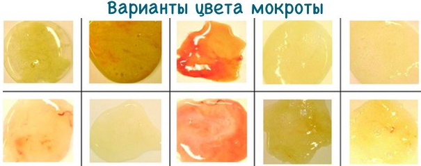 Как провериться на туберкулез взрослому человеку. Анализ по крови, Инвитро, гемотест