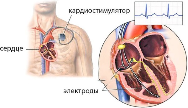 Вредно ли для здоровья МРТ? Противопоказания для детей, взрослых, беременных