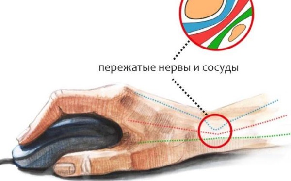 Карипаин. Инструкция по применению, аналоги, цена, отзывы