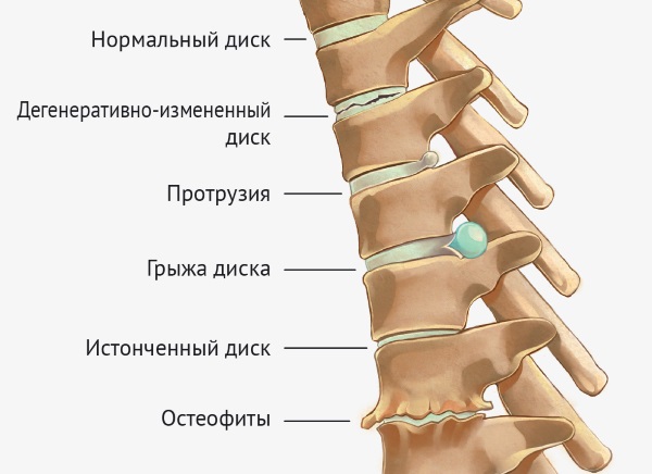 Карипаин. Инструкция по применению, аналоги, цена, отзывы
