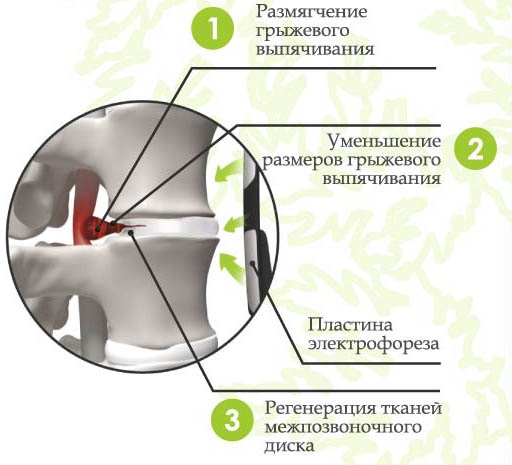 Карипаин. Инструкция по применению, аналоги, цена, отзывы