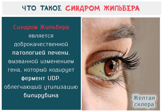 Корвалол при синдроме Жильбера. Как и сколько принимать