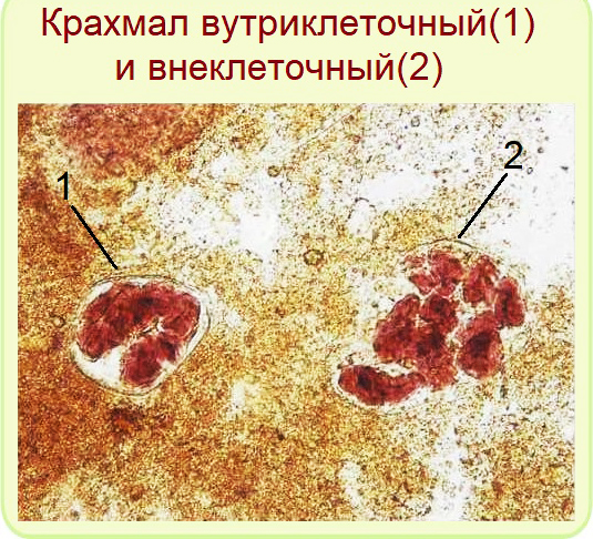 Крахмал внеклеточный в кале у ребенка. Что это значит