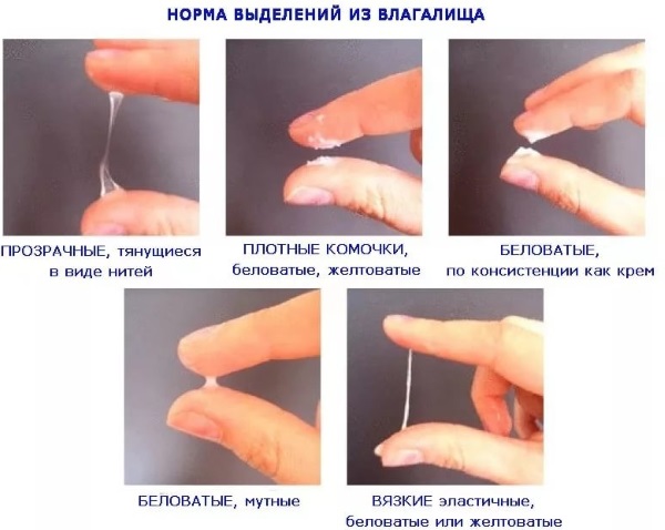 Кровянистые выделения в середине цикла межменструальные, темные, при приеме противозачаточных