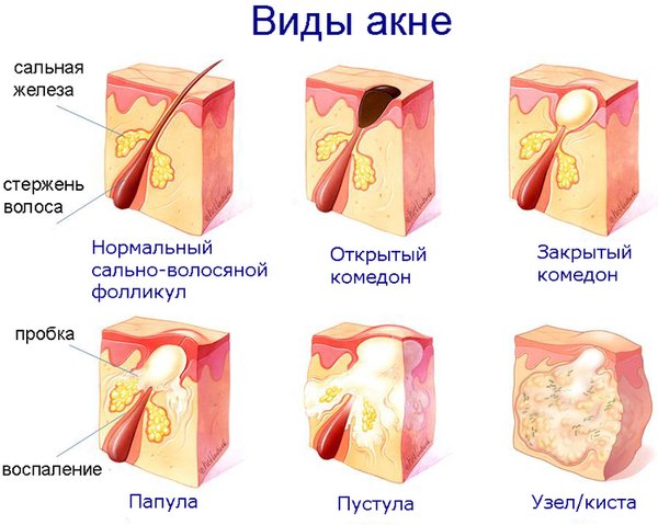 Серно-дегтярная мазь. Цена, отзывы