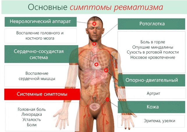 Лечение тазобедренного сустава народными средствами, без операции, инъекциями