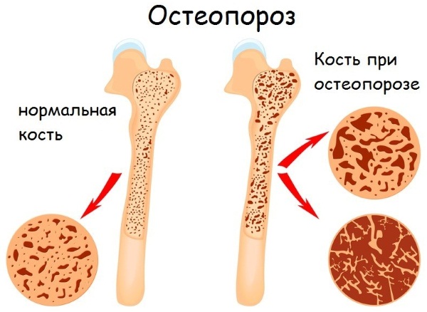 Климонорм (Klimonorm) для женщин при климаксе. Отзывы, инструкция по применению, аналоги, состав, цена