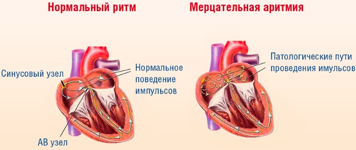 Лидокаин 10-процентный в ампулах. Инструкция, для чего применяют, цена