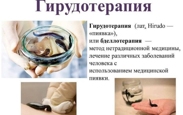 Лечение лимфостаза нижних конечностей в домашних условиях народными средствами, медикаментозно, упражнениями, массажем, диетой